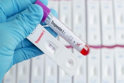 Test na prisustvo Helicobacter pylori i okultno krvarenje u stolici u laboratoriji Inep
